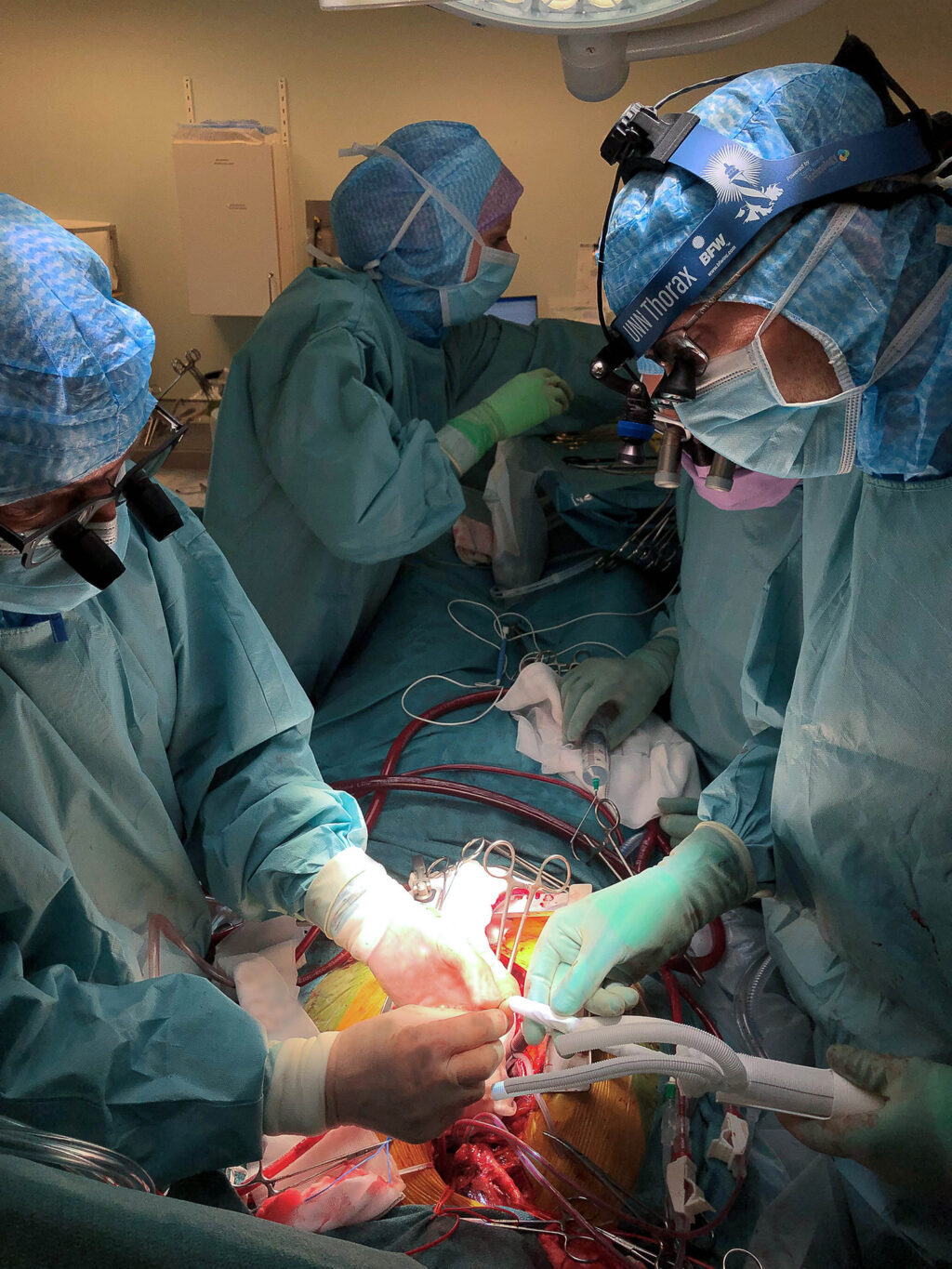 aorta operasjon (1 of 1)