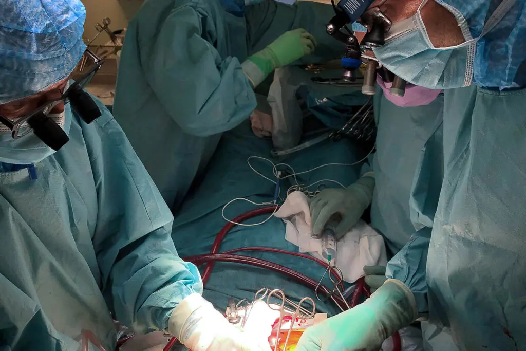 aorta operasjon (1 of 1)