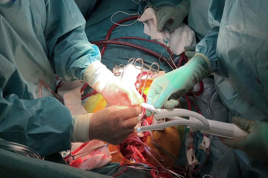 aorta operasjon fremhevet