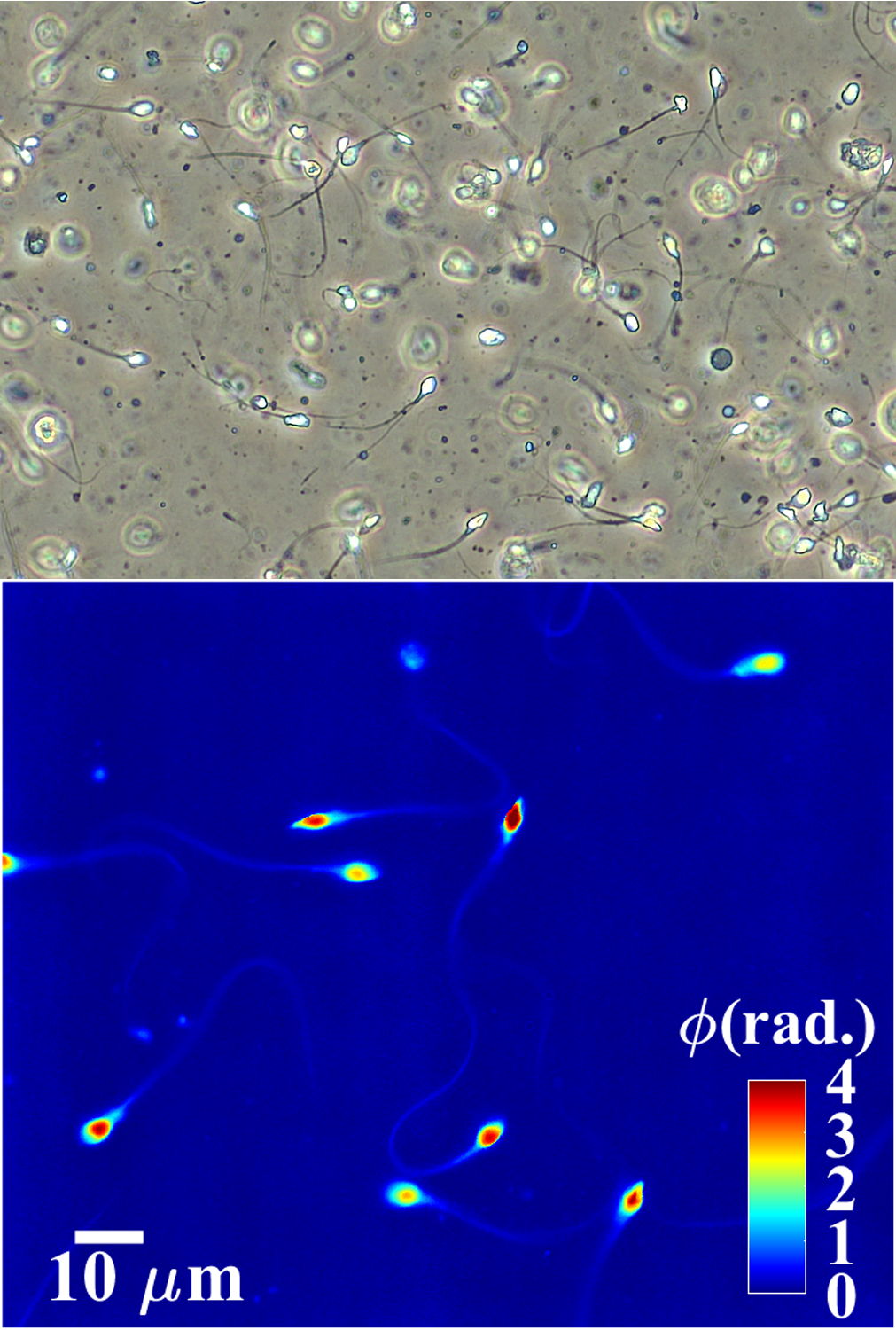 Mikroskopbilde spermier IVF 2D og 3D