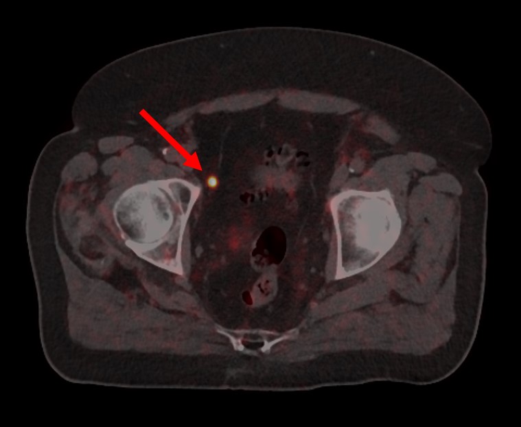 Et sirkulært objekt med et hull i