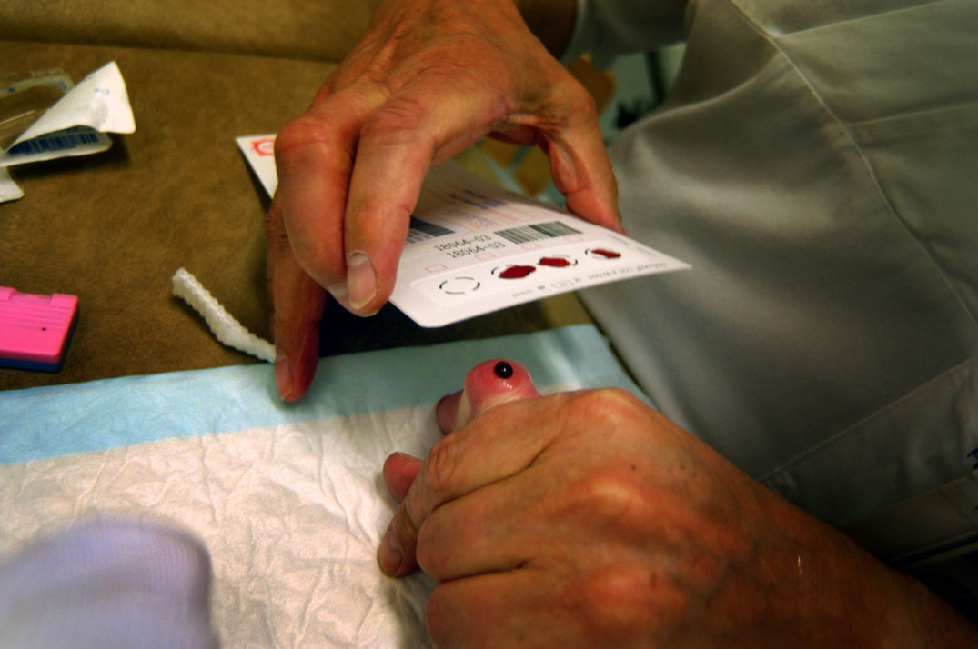 For å oppnå optimale resultater bør blodprøven tas mens babyen er mellom 48 og 72 timer gammel. Foto: Rune Stoltz Bertinussen