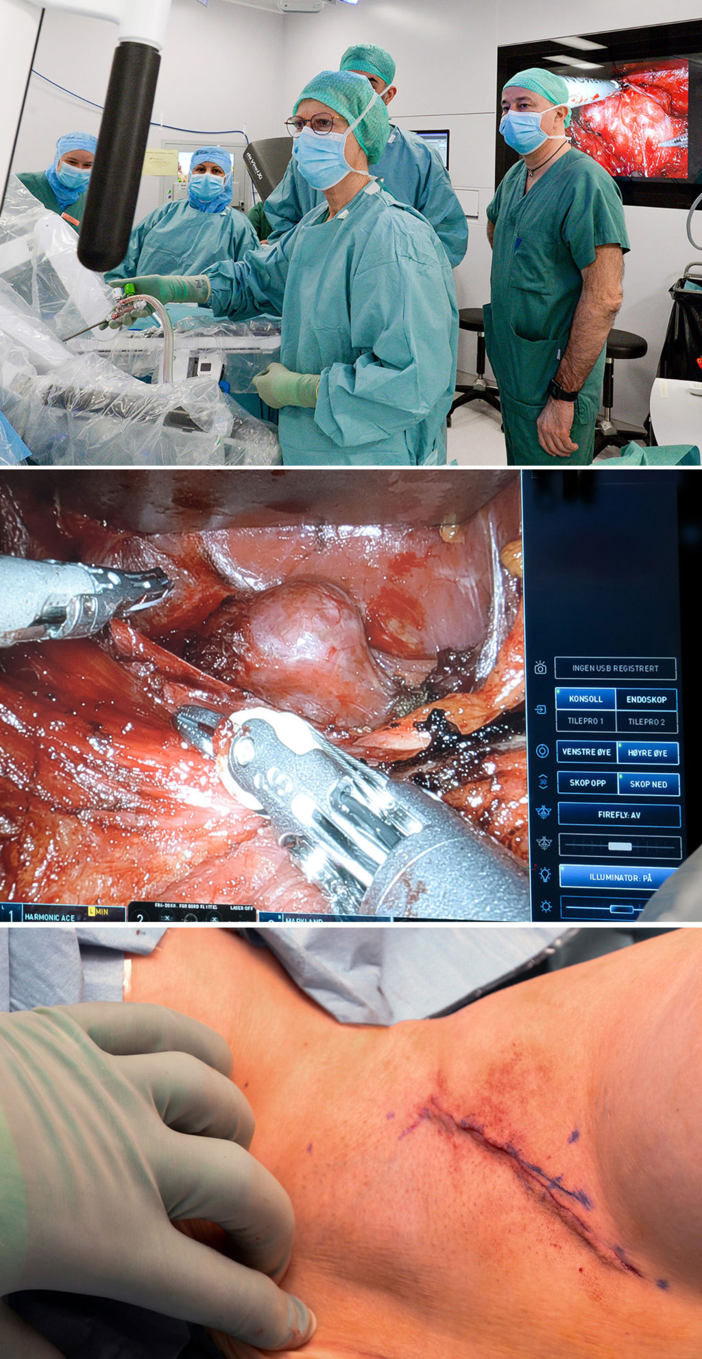 Et collage av en person i kirurgisk uniform og maske