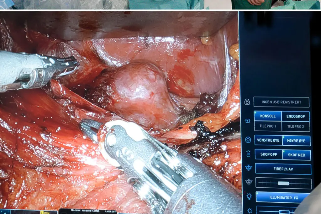 Et collage av en person i kirurgisk uniform og maske