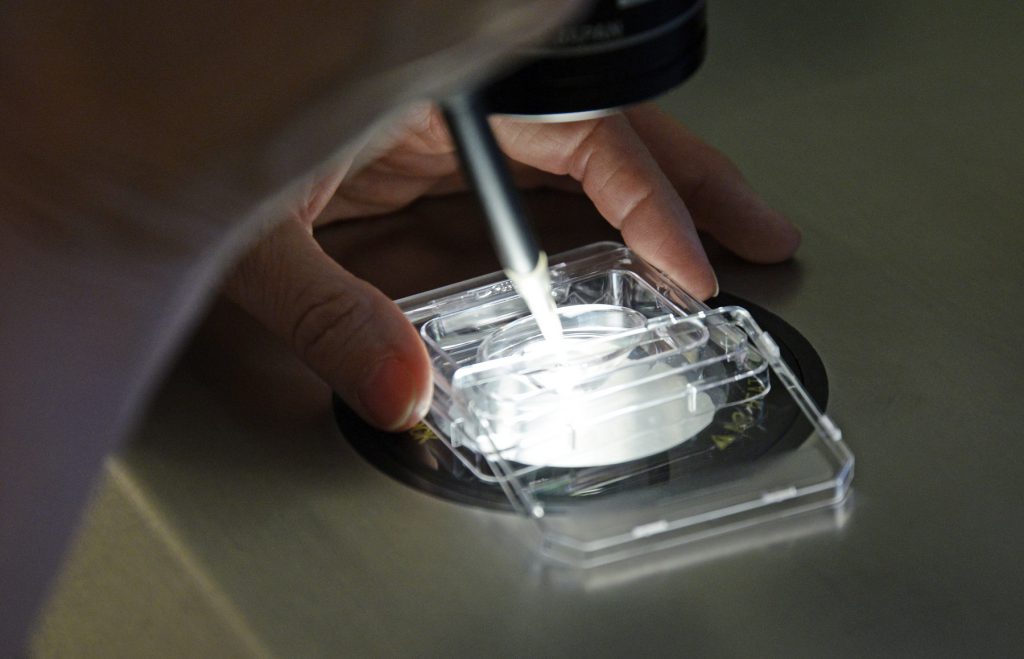 En person som holder en gjennomsiktig beholder med et hvitt stoff i