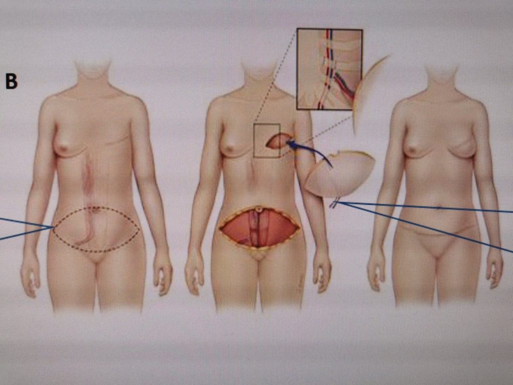 En gruppe menneskeskjeletter