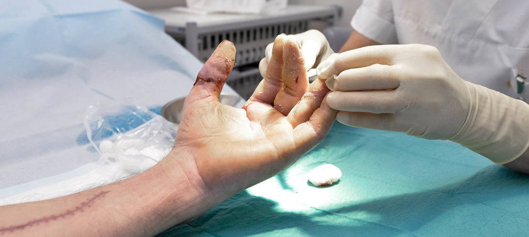 En persons hånd som holder et hvitt objekt over en blå overflate