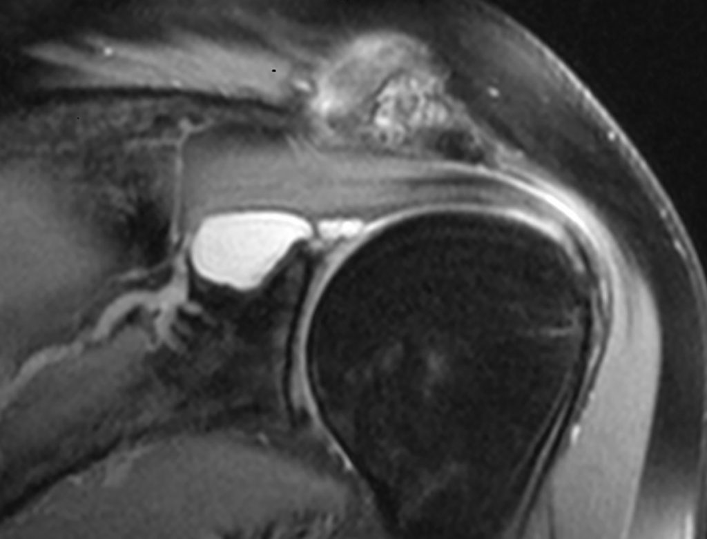 Et nærbilde av baksiden av en persons hode