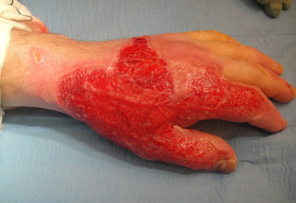 Et nærbilde av en menneskefot