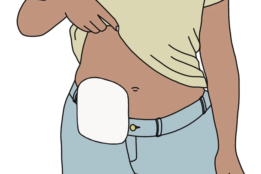 Person som har en pose over blottet mage