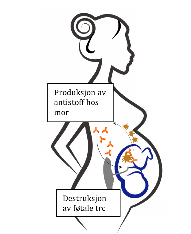 Gravid dame