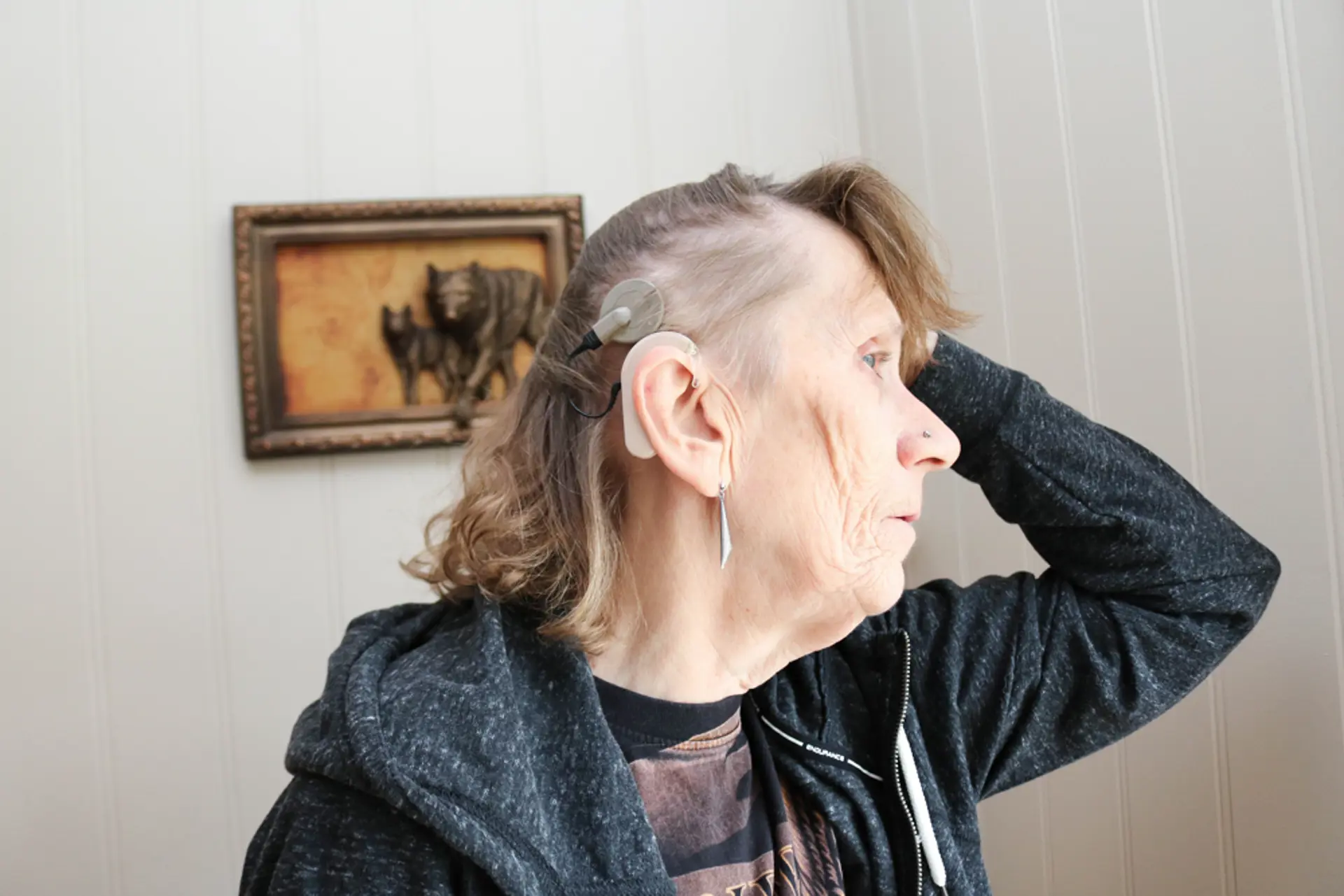 Kvinne med implatat i øret