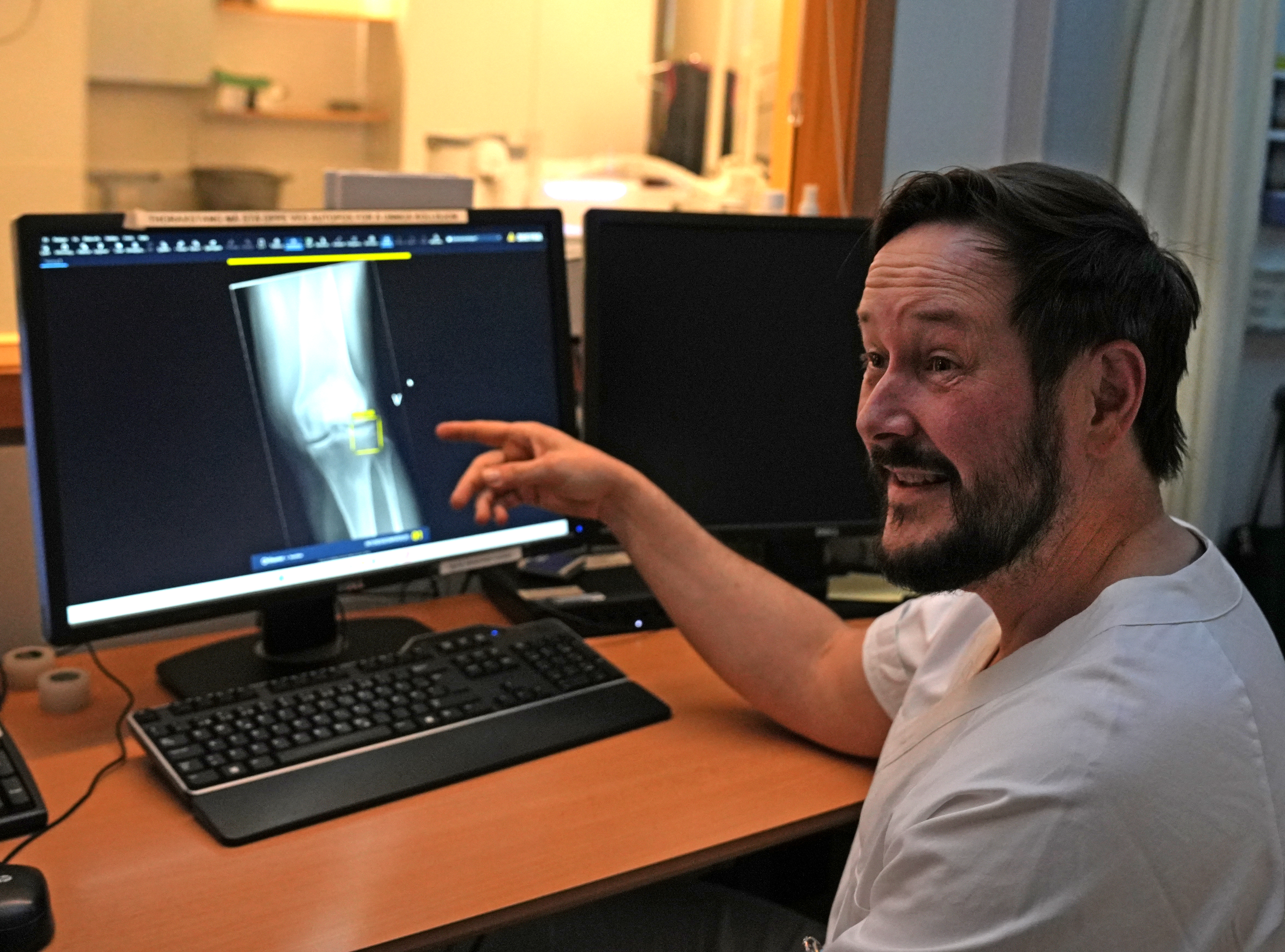 Radiograf Tom Jørgensen og KI-verktøyet Boneview