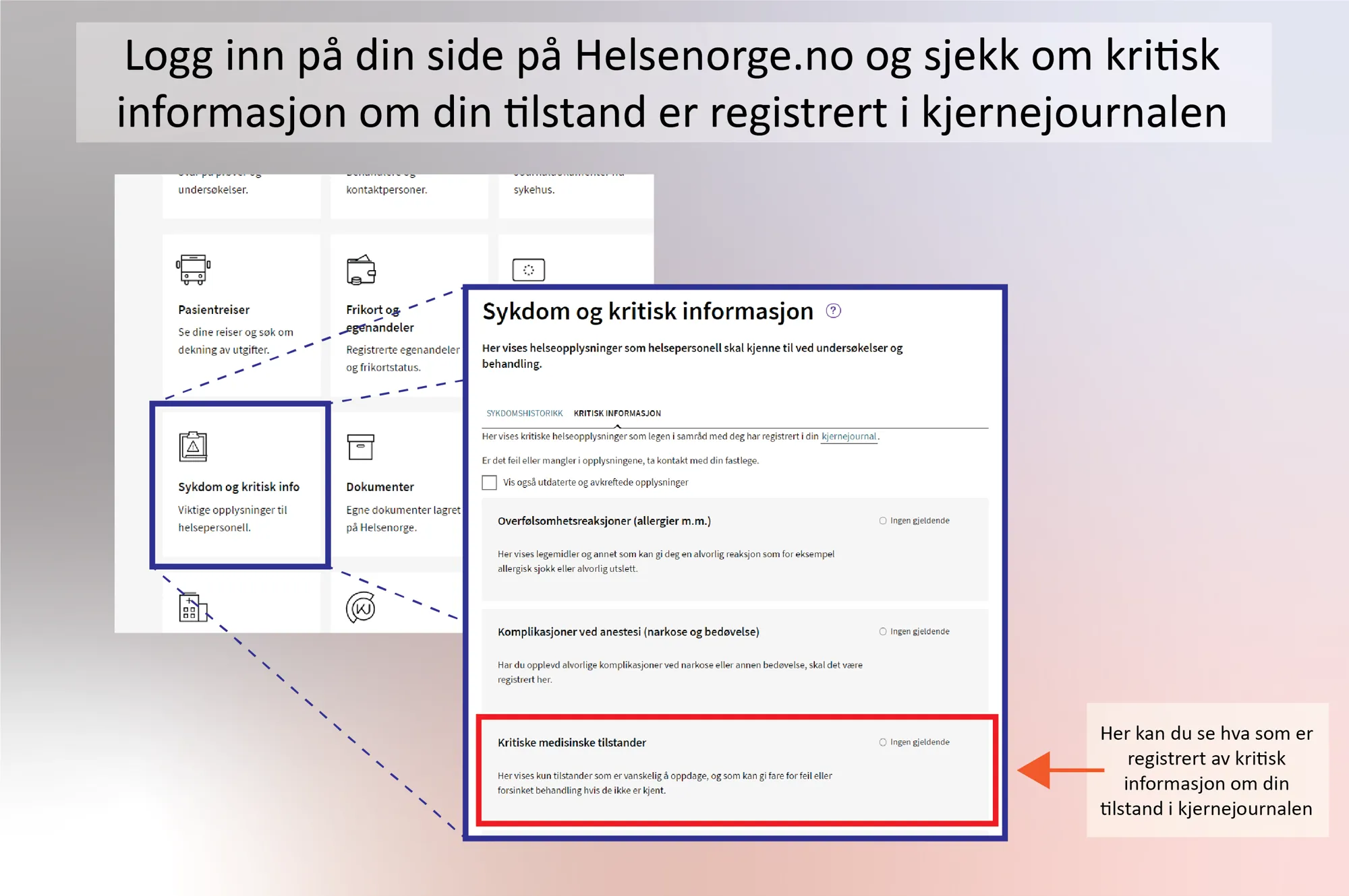 En veiledning for hvordan du kan sjekke om kritisk informasjon er registrert i din kjernejournal
