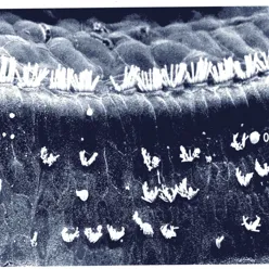 Et svart-hvitt-bilde av ødelagte hårceller