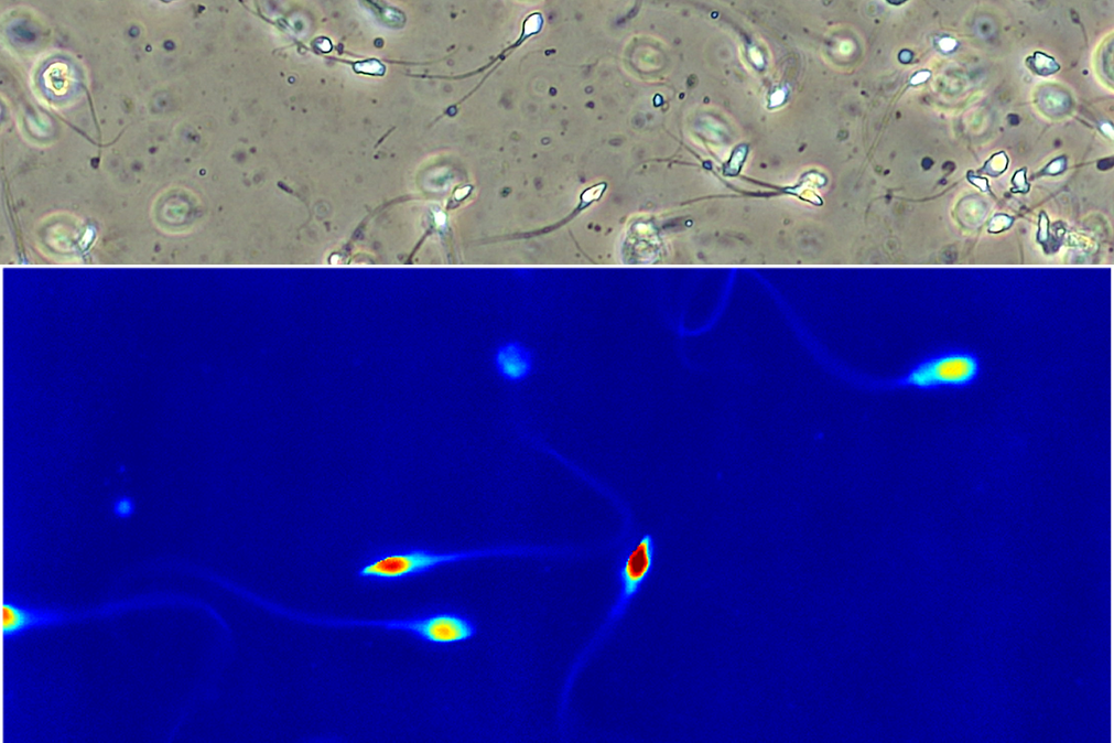 Mikroskopbilde spermier IVF 2D og 3D