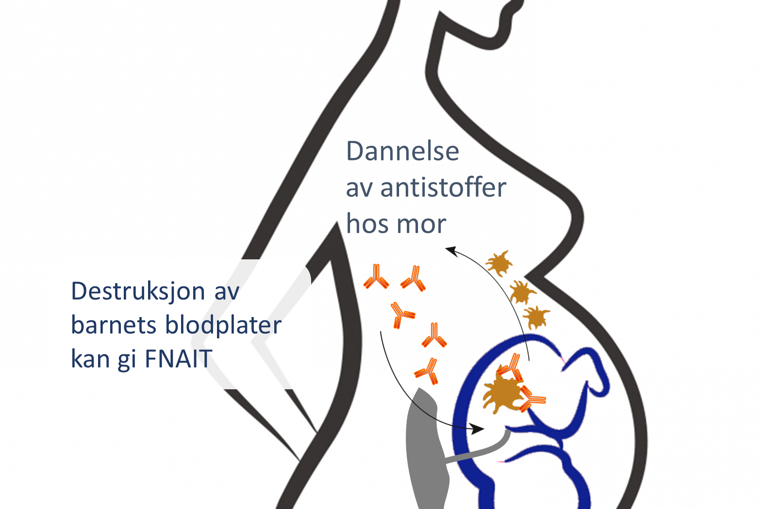 Gravid kvinne med antistoffer som påvirker fosteret