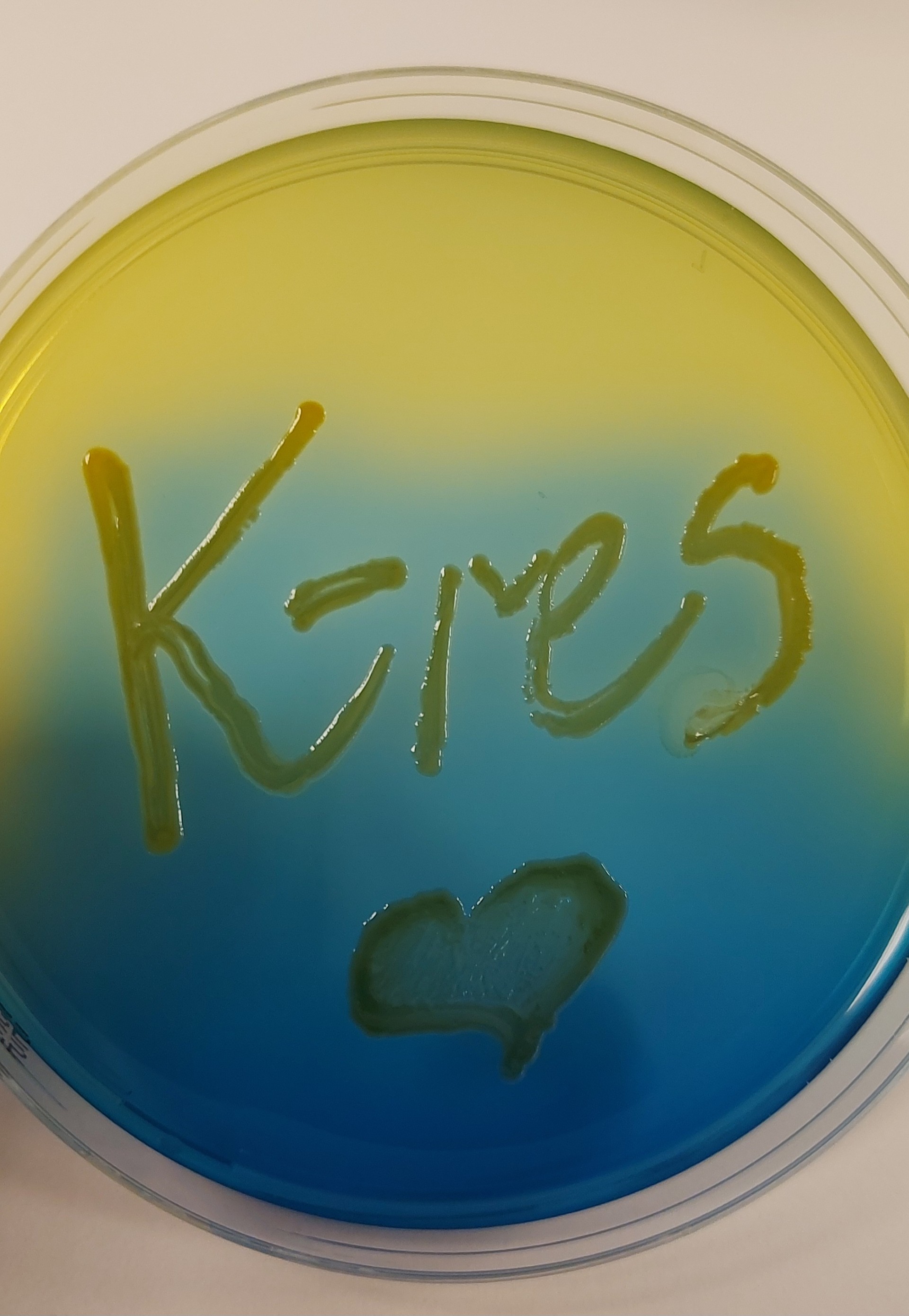 Sirkel hvor det står K-res