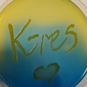 Sirkel hvor det står K-res